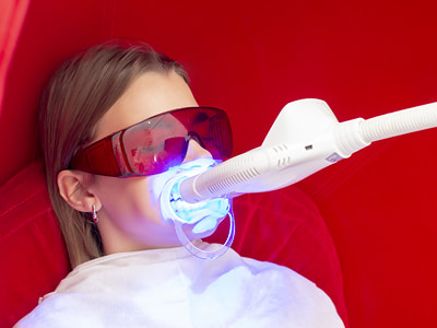 estetska stomatologija i izbjeljivanje zubi